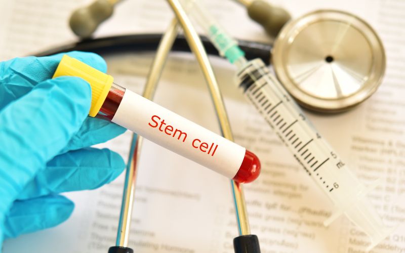 stem cell